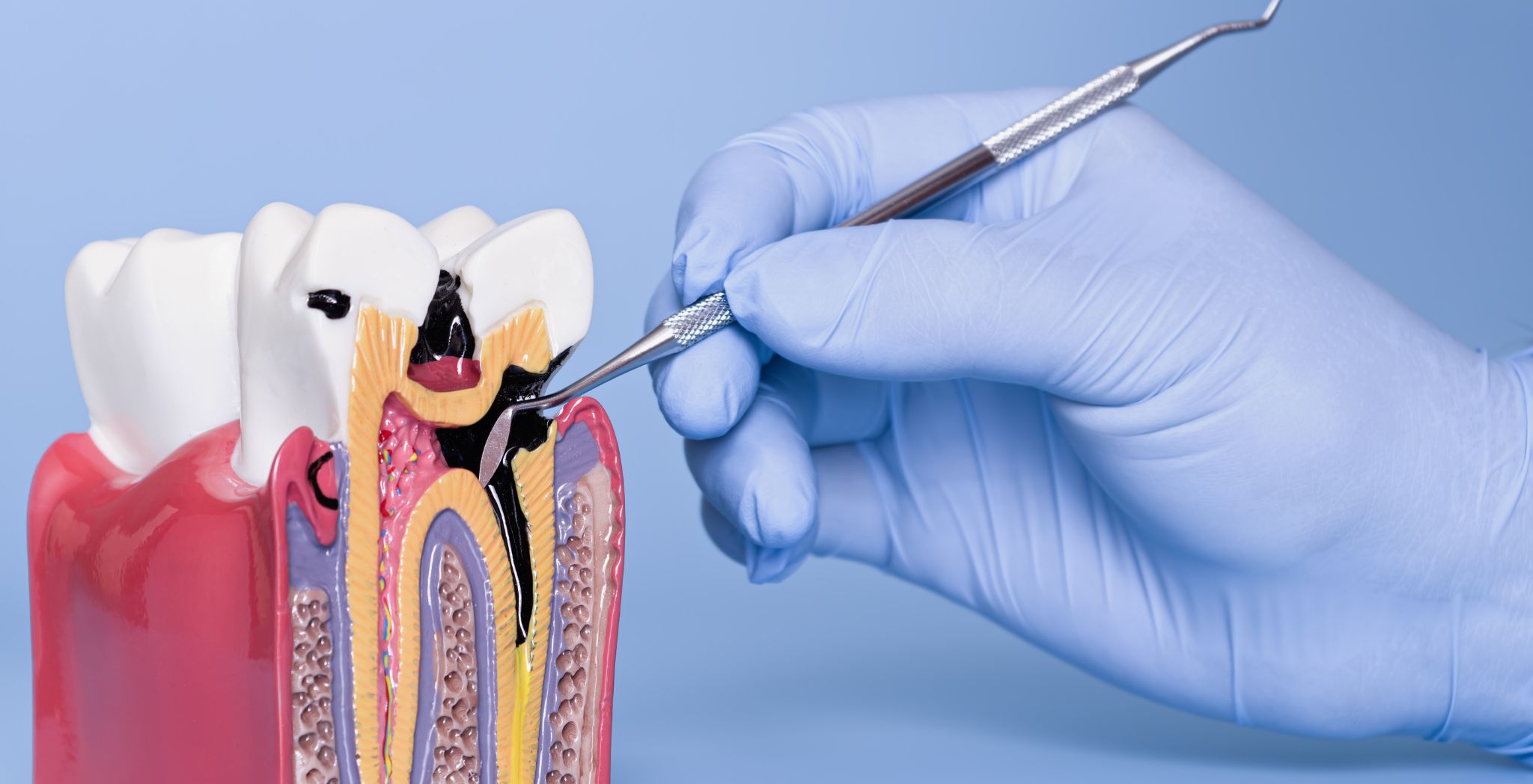 Dental Erosion Causes, Causes of dental erosion, Factors leading to tooth erosion, Acidic foods and dental erosion